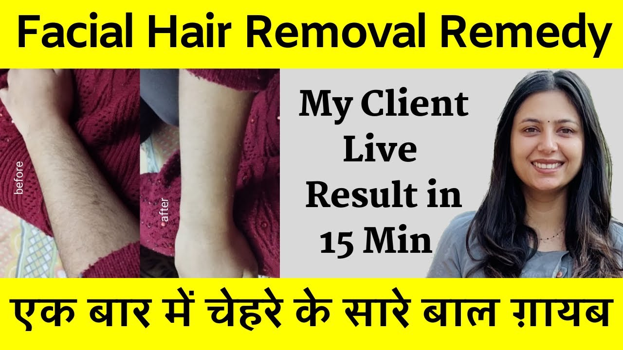 7 Days Challenge Remove Facial Hair Permanently | PCOD Facial Hair Remedy | Dr. Upasana Vohra