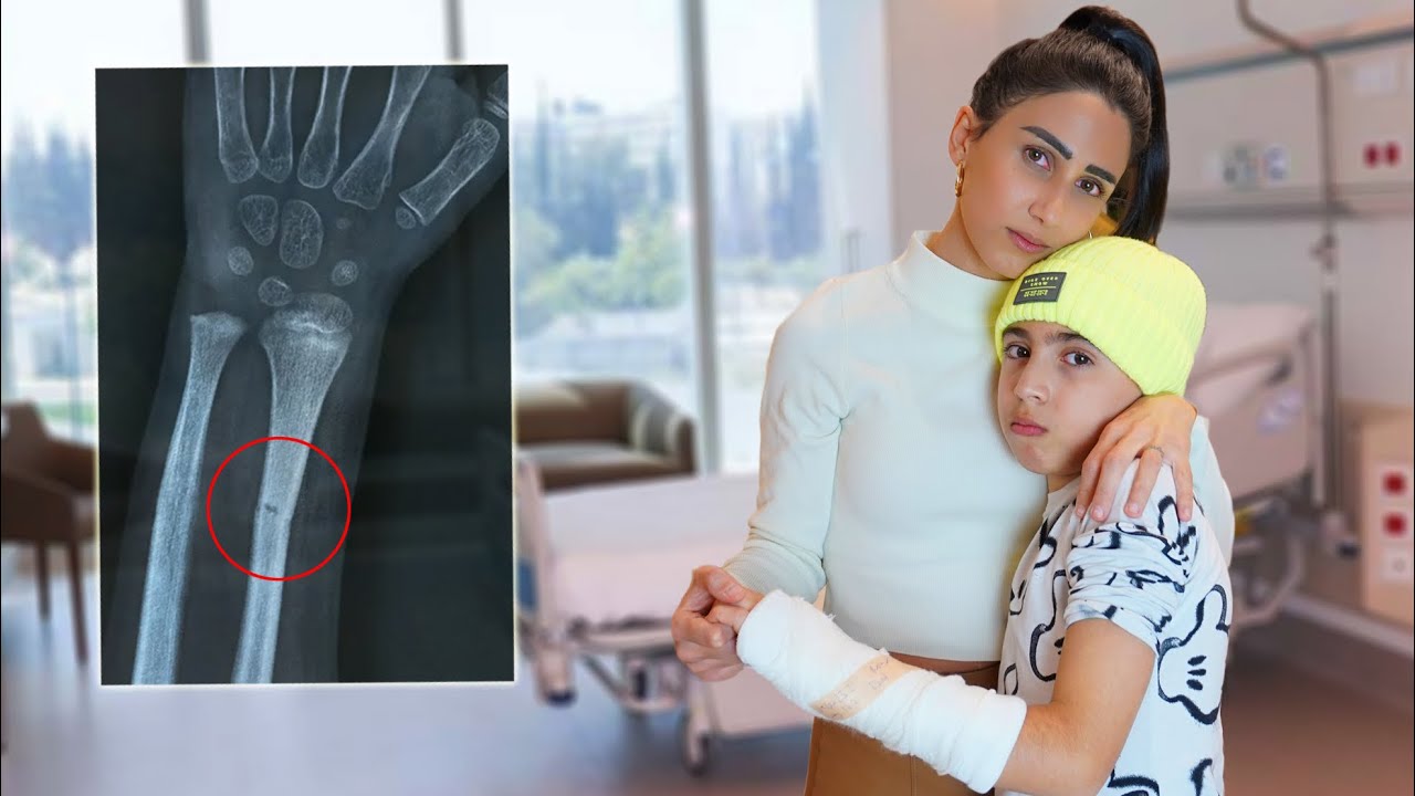 ابننا كسر يده 🥺🚑 (رحنا المستشفى)