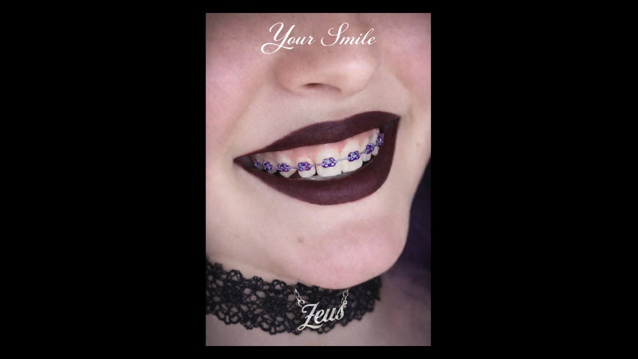 Your Smile