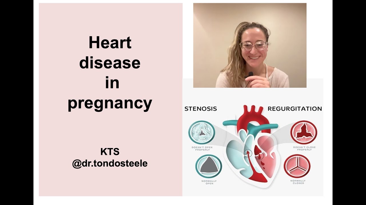 Heart disease in pregnancy: Valvular Disease