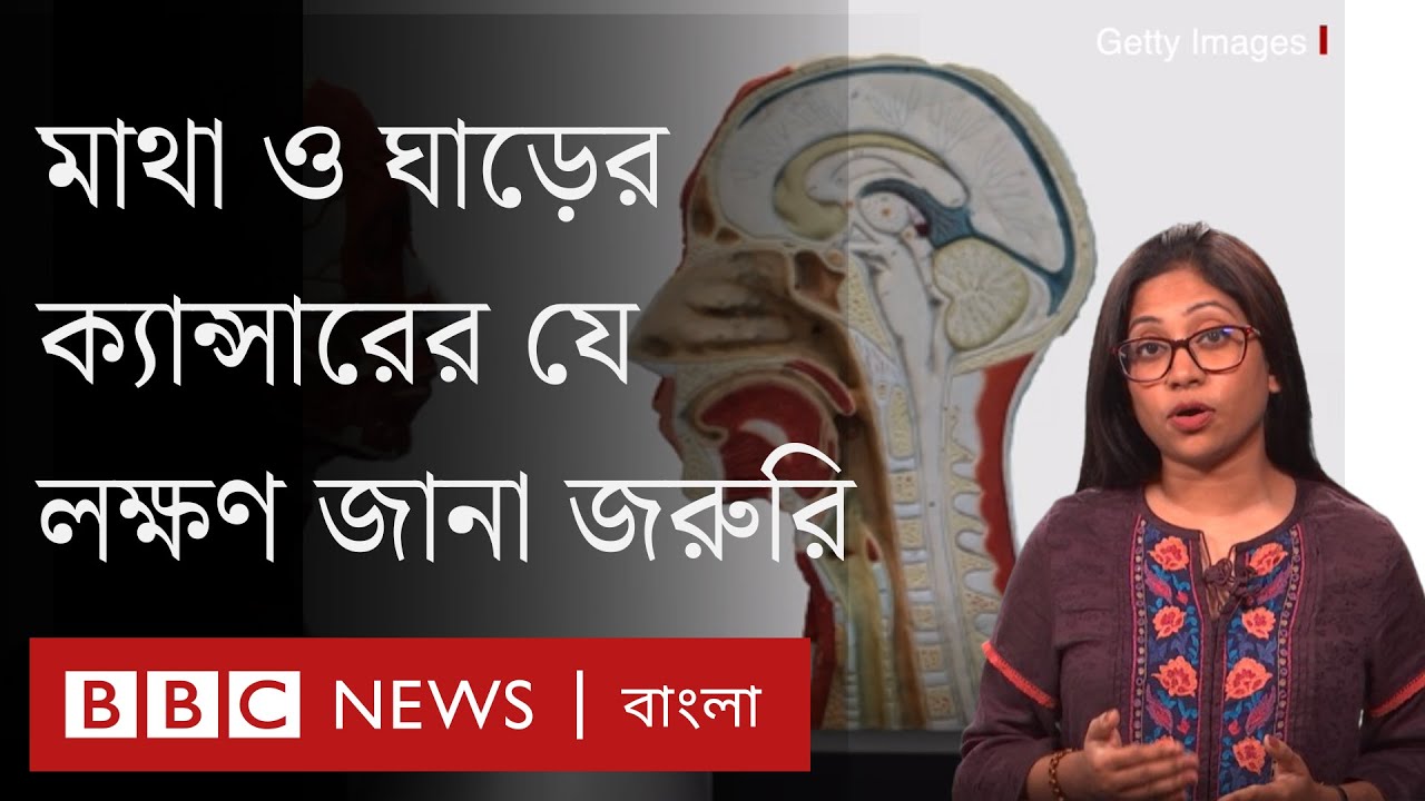মাথা ও ঘাড়ের ক্যান্সার: যে লক্ষণগুলো এড়িয়ে যাবেন না
