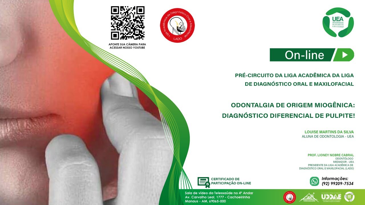 LADO - Odontalgia de origem miog&ecirc;nica: Diagn&oacute;stico diferencial de pulpite!