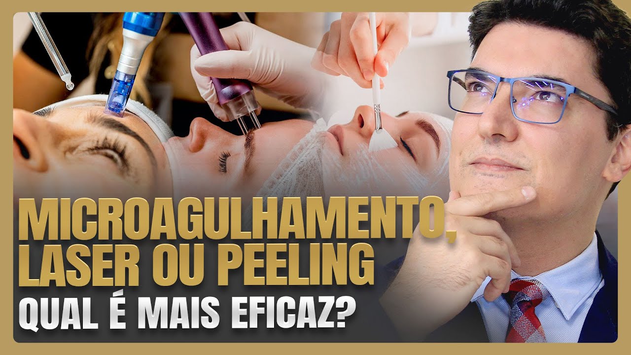 MICROAGULHAMENTO, LASER OU PEELING: qual é mais eficaz?