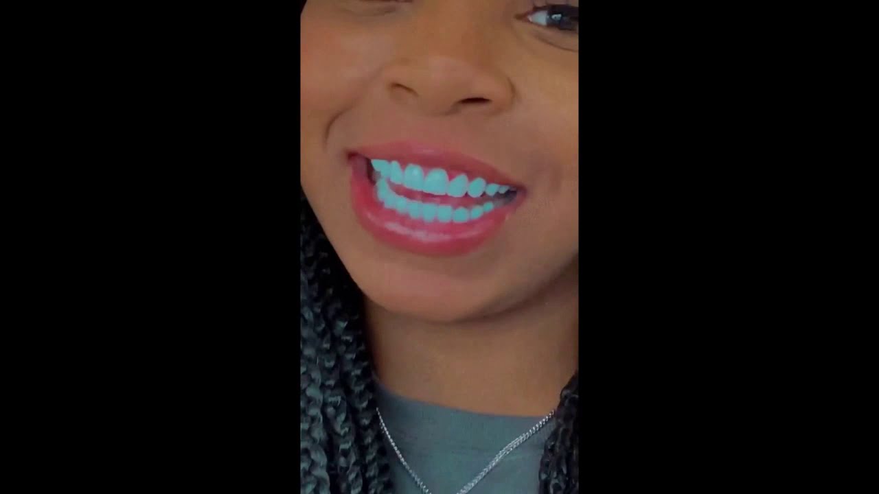 Light skin Keisha with the new Teeth- Celebrity Instagram