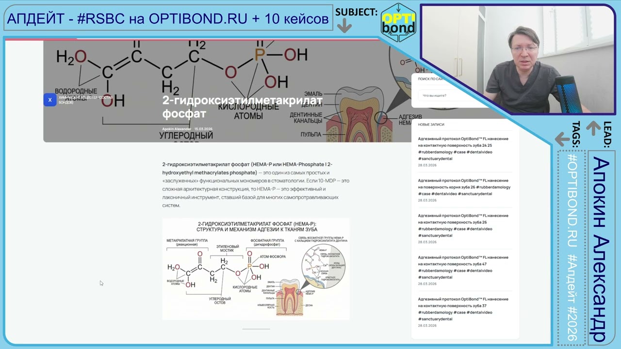 АПДЕЙТ - #RSBC на OPTIBOND.RU + 10 кейсов &mdash; 2026 #rubberdamology - Часть 18 4K