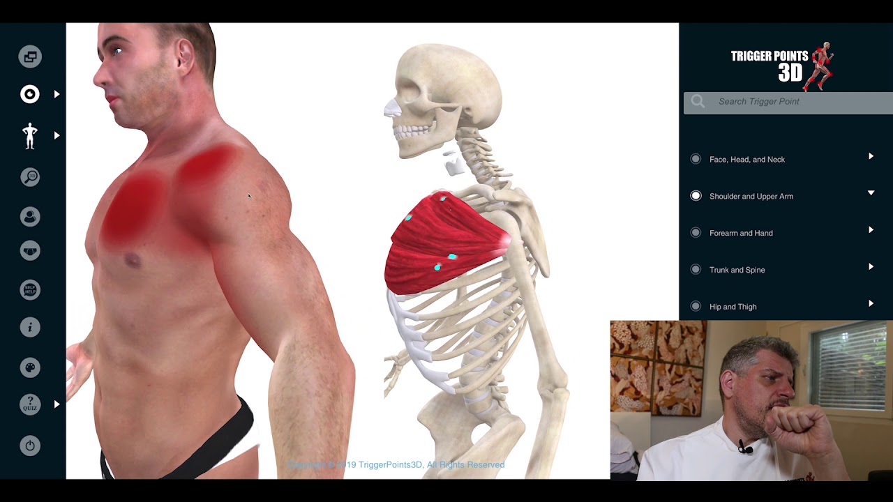 Pectoralis Major - Trigger Point of the Week