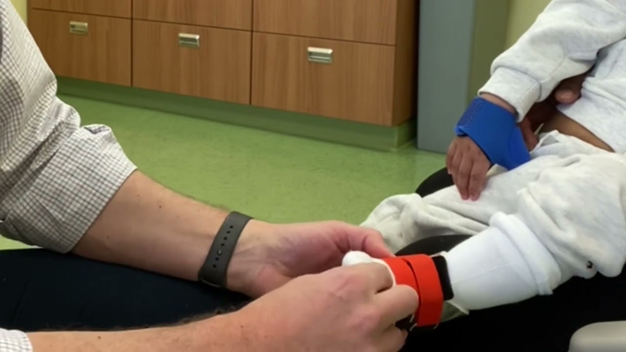 Surestep SMO’s and AFO – how to put on AFO‘s. ￼
