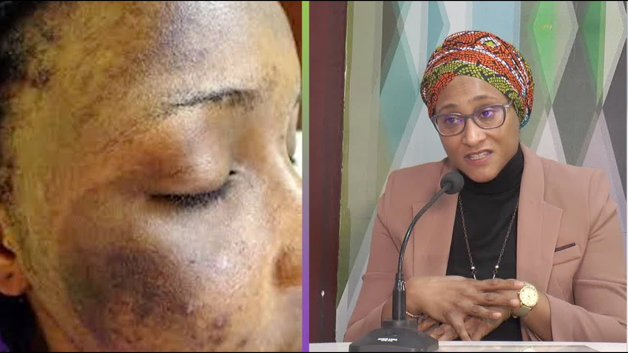 BUSINESS SANTÉ : La dépigmentation volontaire de la peau
