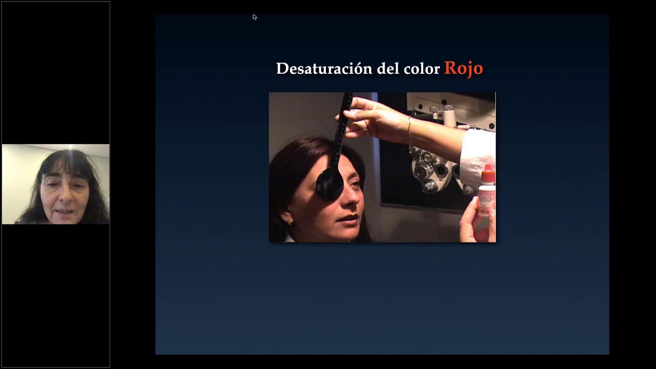 Seminario Conociendo la Neuritis óptica: Un Enfoque Básico - US Ophthalmic