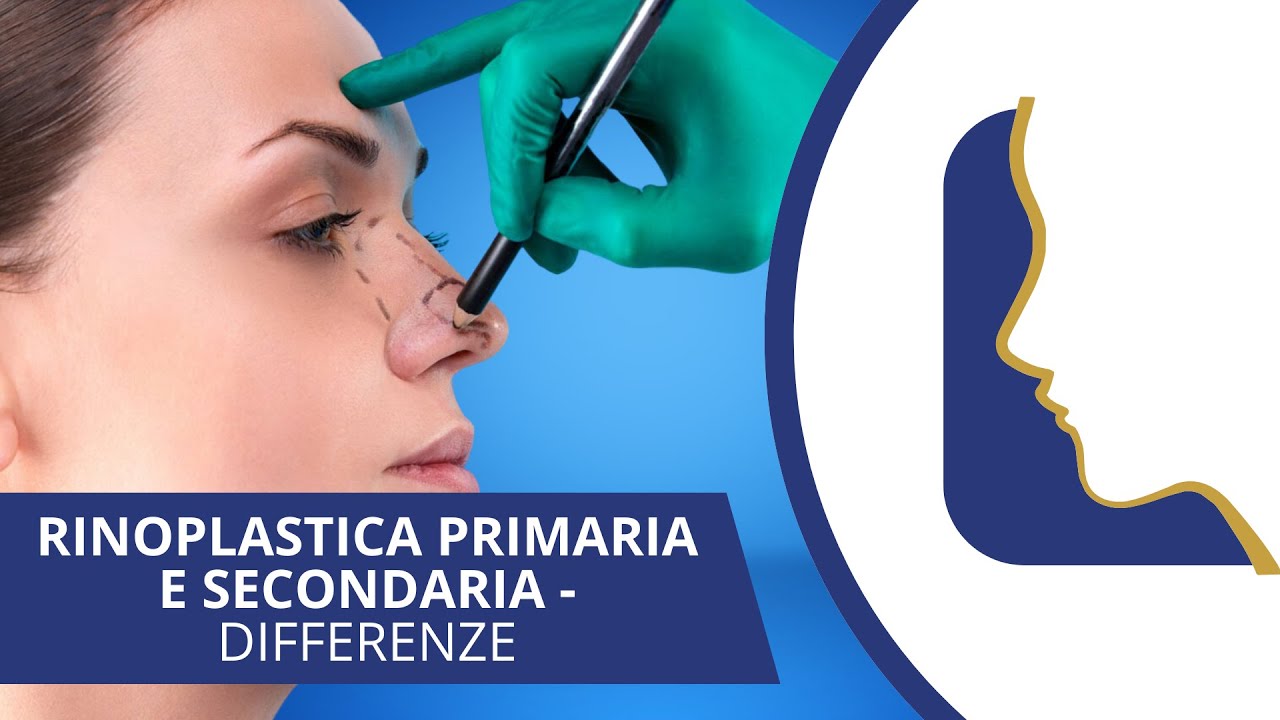 Rinoplastica: scopri la differenza tra primaria e secondaria!
