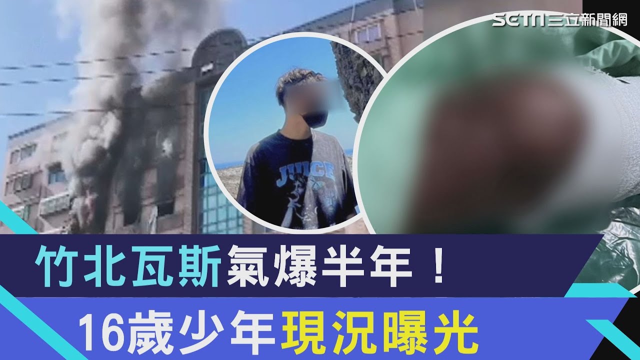 氣爆少年／91%燒傷頭皮補全身！一句「妳不該把我救出來」　媽聽完淚崩｜三立新聞網 SETN.com