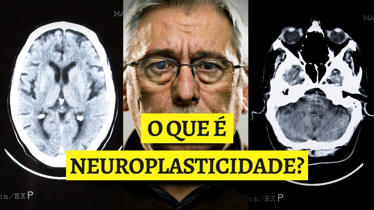 O que &eacute; neuroplasticidade cerebral? Entenda Como Seu C&eacute;rebro se Adapta