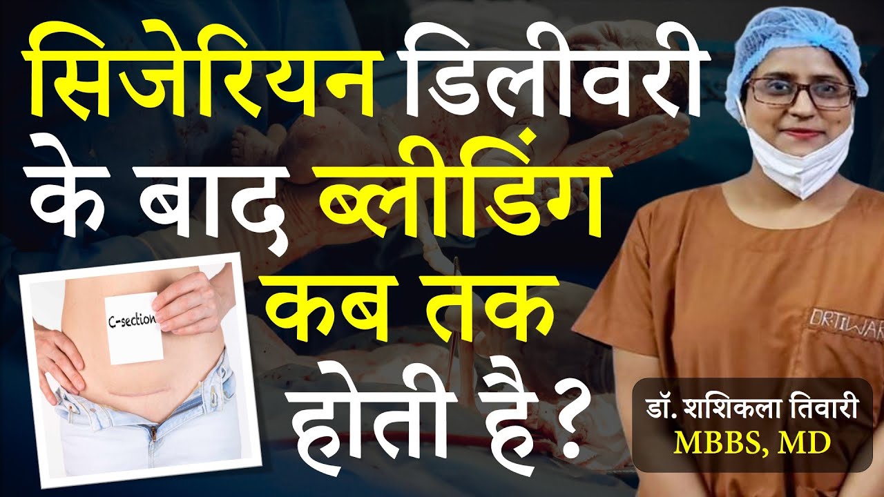 C Section Delivery Ke Baad Bleeding Kab Tak Hoti Hai | Super Mummy | Dr. Shashi Kala Tiwary