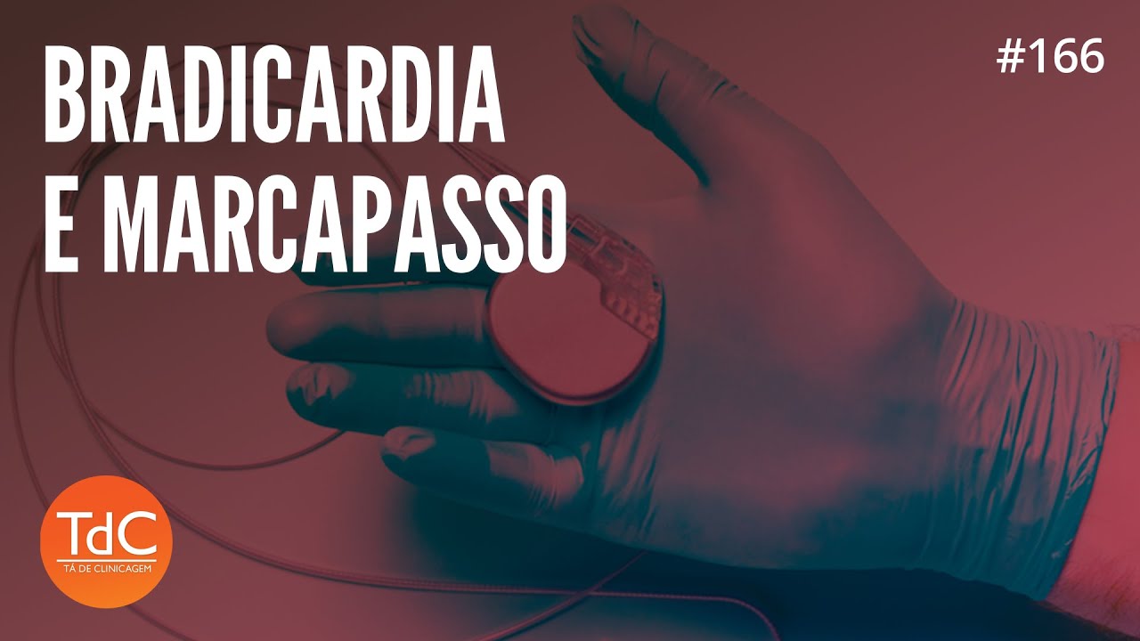 Bradicardia e Marcapasso - Episódio 166