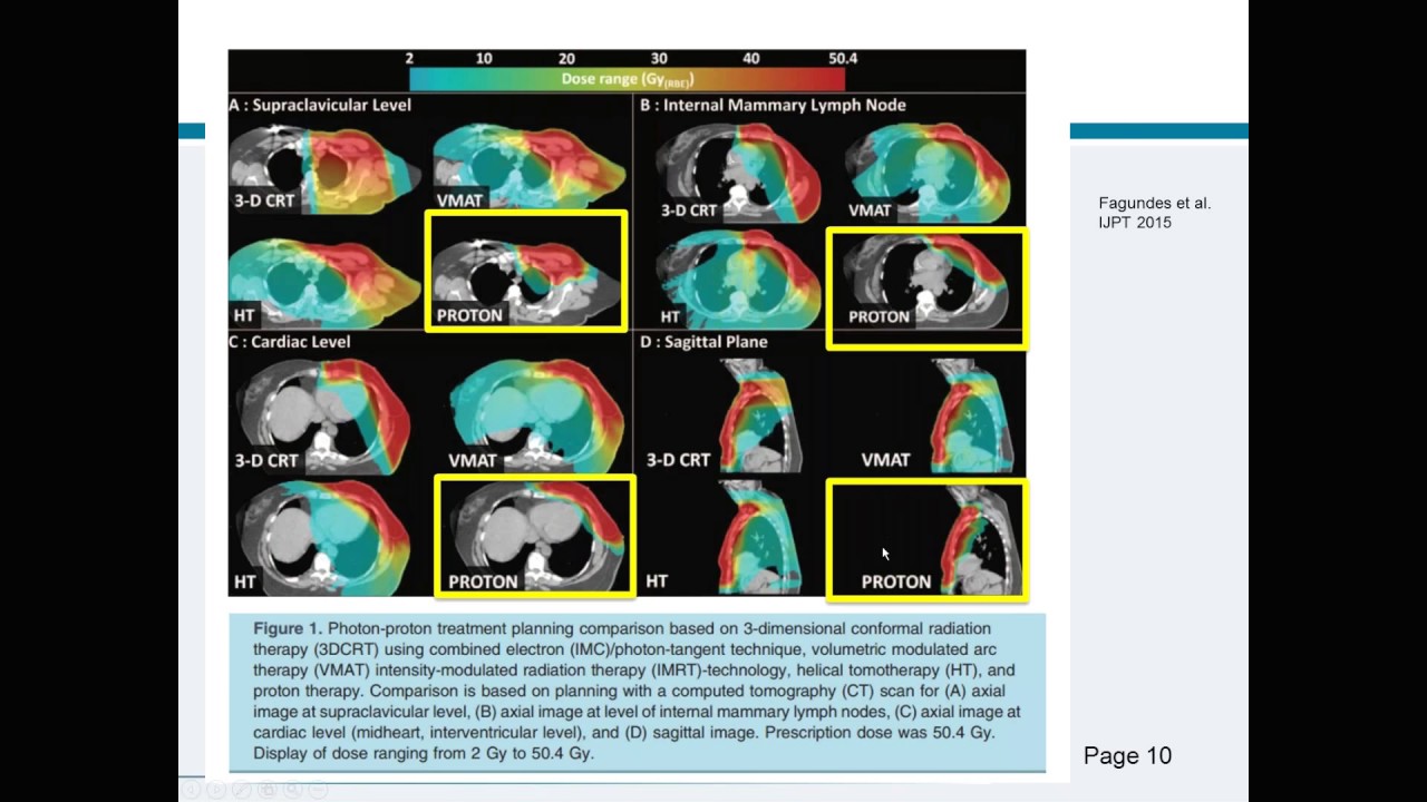 Proton Therapy Treats Women's Cancers Differently