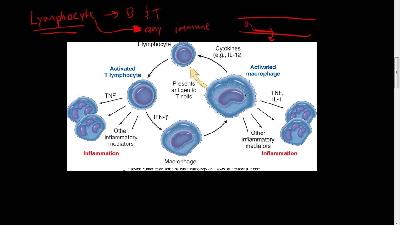 #29 - Chronic inflammation - Hematopoiesis, Lymphocytes, Macrophages, IFN-y