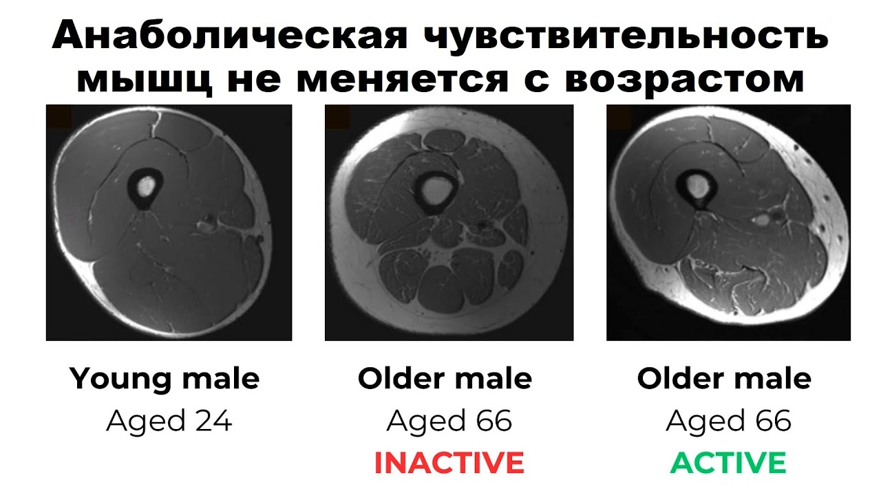 Анаболическая чувствительность мышц не меняется с возрастом