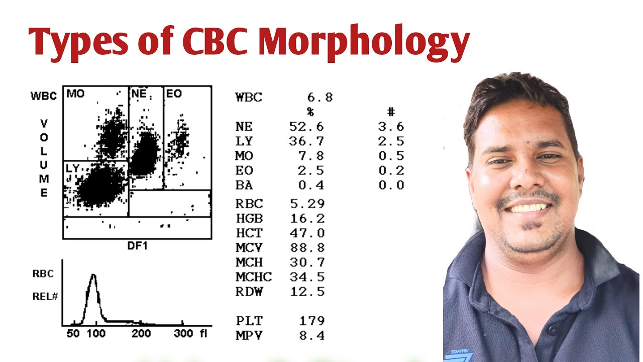 Peripheral Blood Morphology