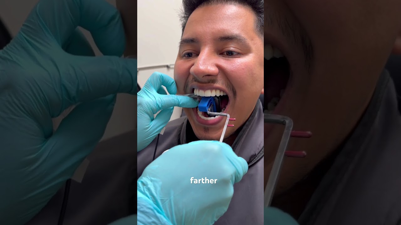 How to take the mandibular anterior PA’s #dentalhygienestudent #xray #dentalassistant #dentist