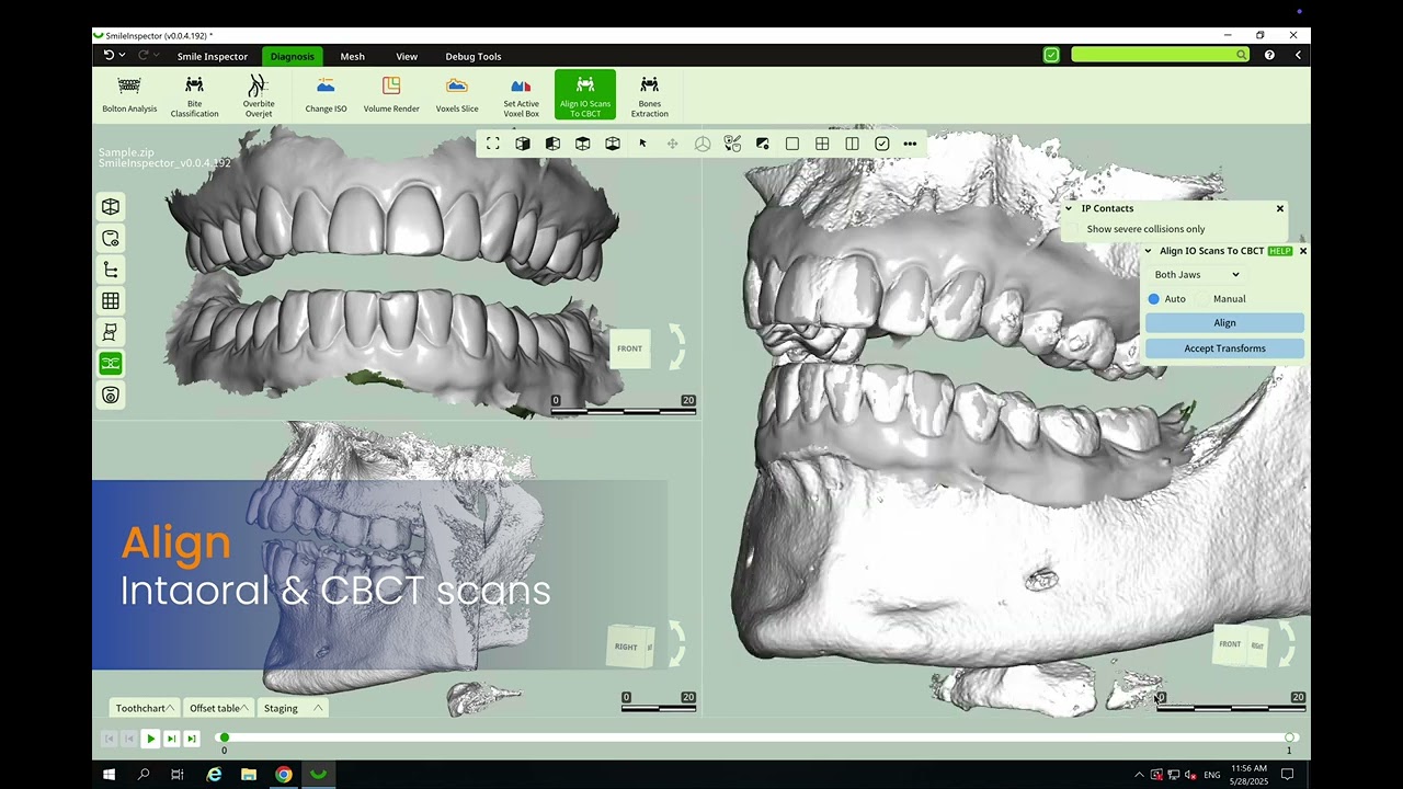 🦷 SmileInspector Features Overview | Beta Coming Soon! 🚀