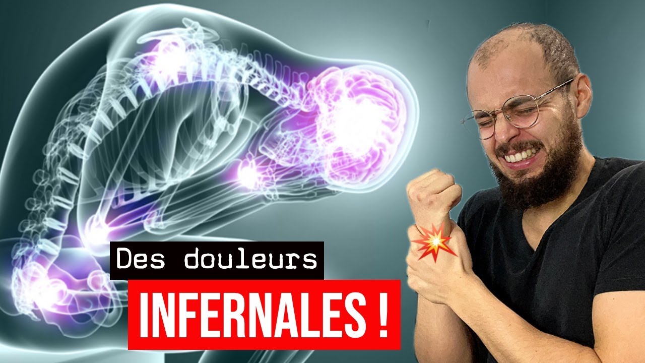 Douleurs NEUROPATHIQUES : les causes les plus fréquentes ! (Hernie discale, zona, diabète…)