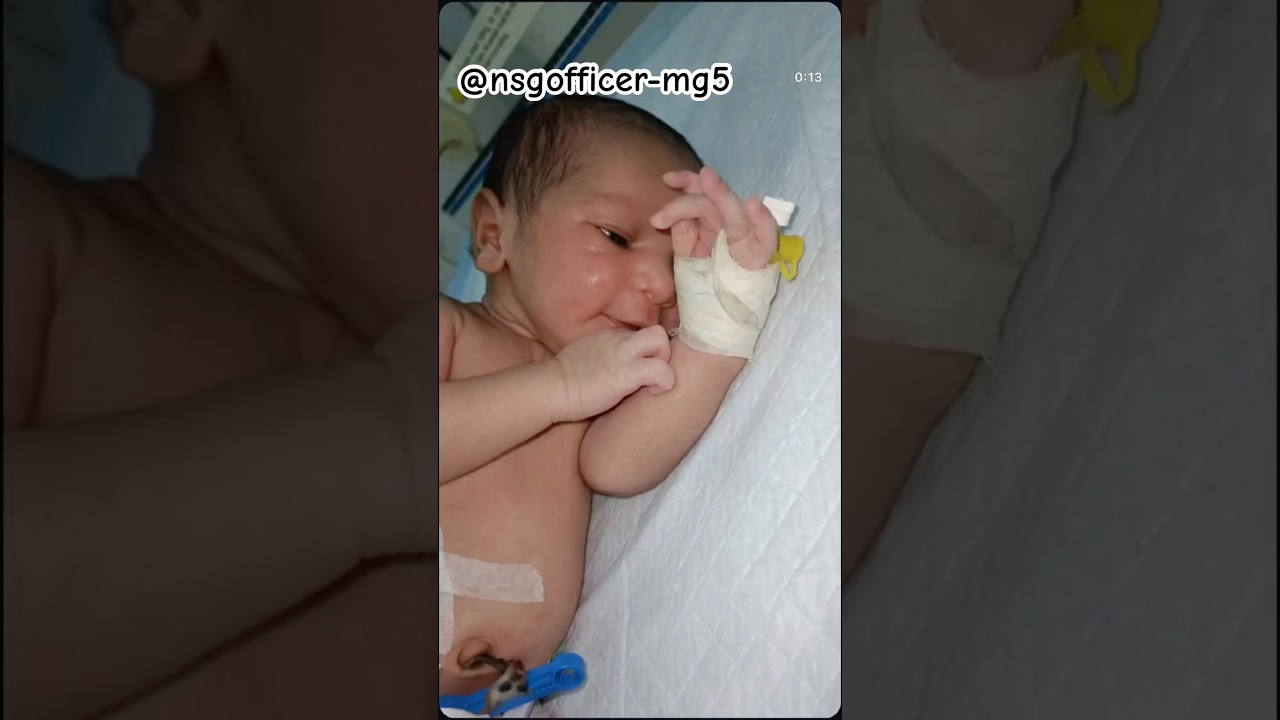 😴cute preterm baby 