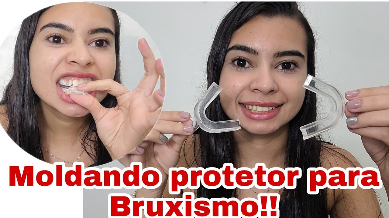 COMO MOLDAR  PROTETOR BUCAL PARA BRUXISMO!!! r&aacute;pido e f&aacute;cil
