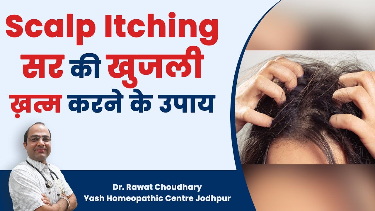 Treatment of Itching in Scalp | सिर में खुजली का इलाज | सिर में खुजली की दवा | सिर में खुजली आना