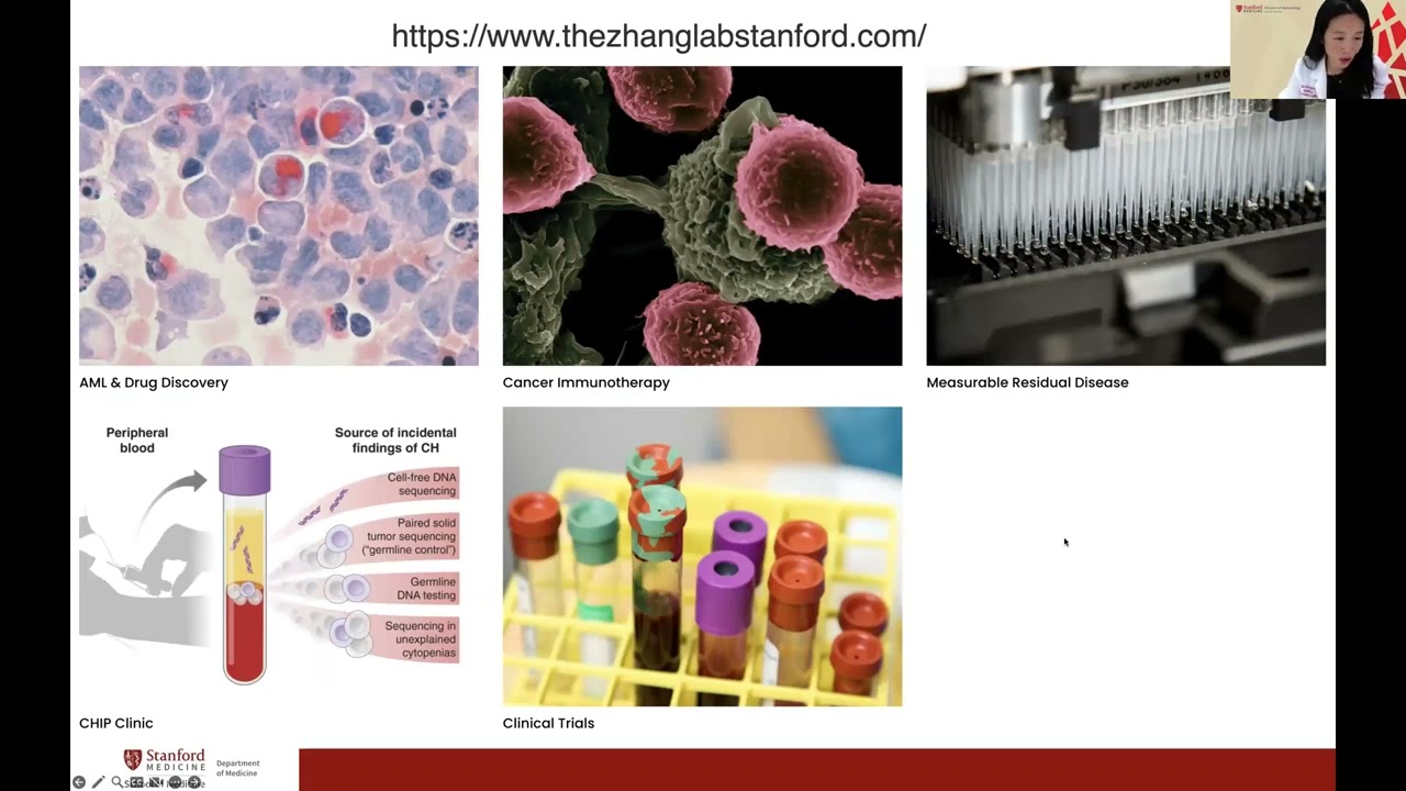 What You Need to Know About MRD for AML: The Basics | Dr. Tian Zhang #AML