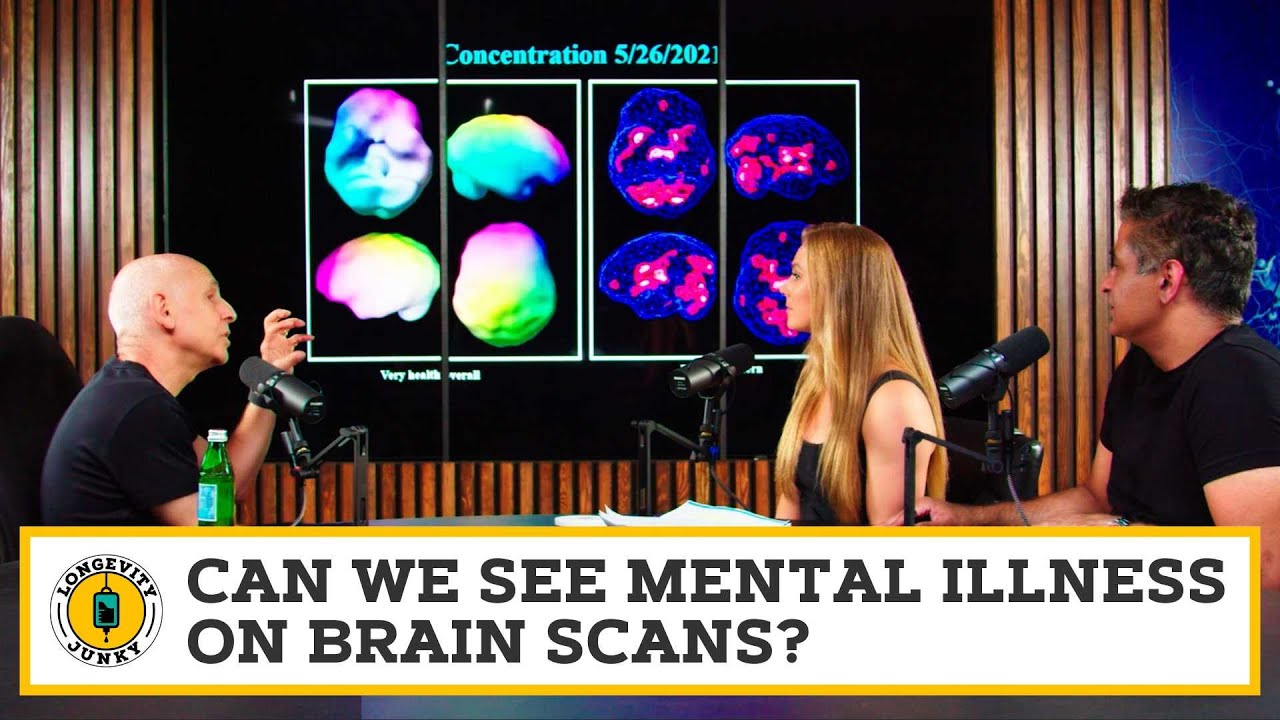 Can we see mental illness on brain scans?