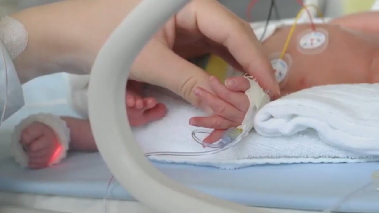 Bubble CPAP for Increased Lung Function in Premature Babies with Hany Aly, MD