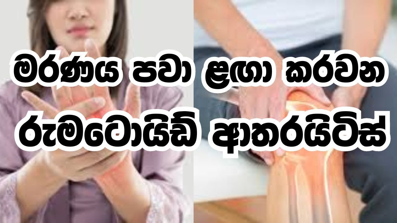 මරණය පවා ළඟා කරවන &lsquo;රුමටොයිඩ් ආතරයිටිස්&rsquo;