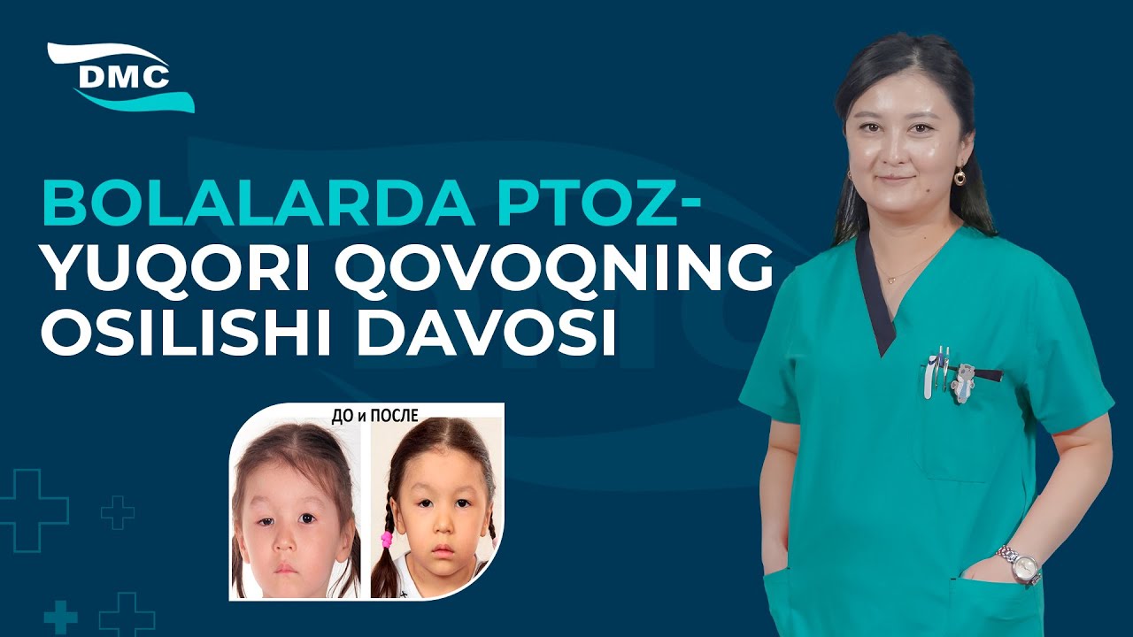 Bolalarda ptoz - yuqori qovoqning osilib qolishi davosi  #DMC_klinika