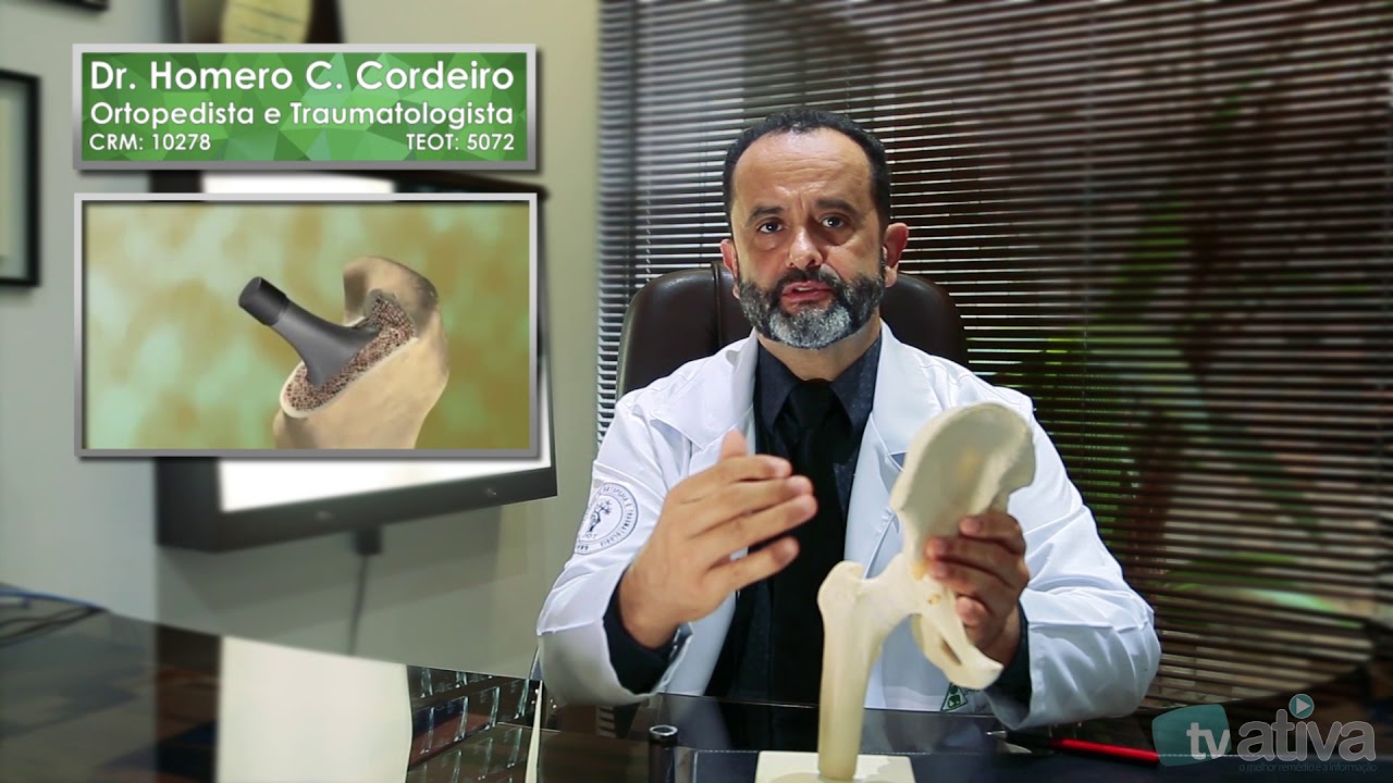 DR HOMERO CORDEIRO - VOCÊ SABE O QUE É COXARTROSE?