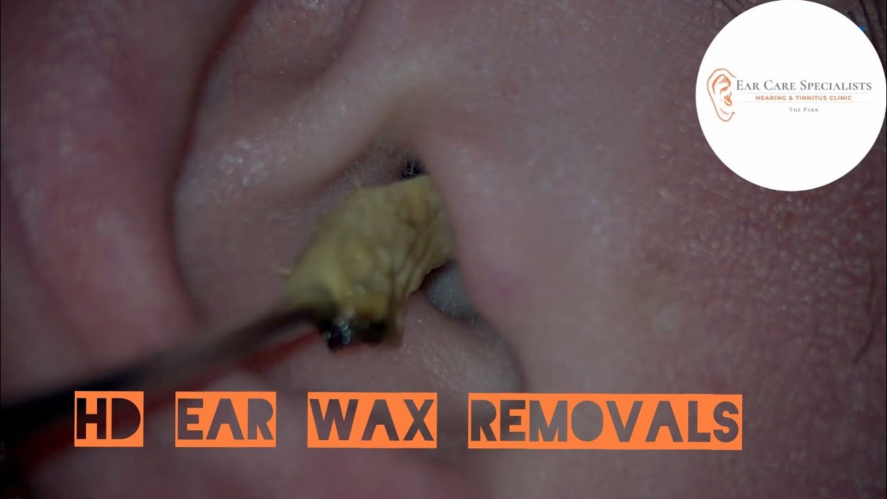 HD ear wax removal compilation | number 3 | Ear Care Specialists | Dr. Jeff | Audiologist