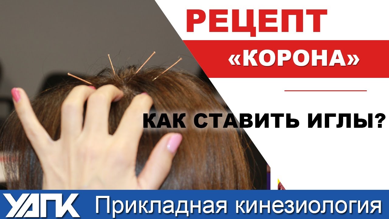 Гармонизация с помощью игл (Е.Чижикова)