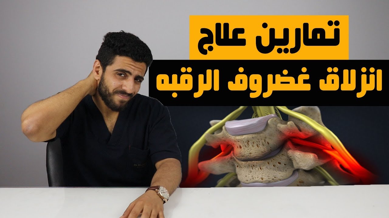 انزلاق غضروف الرقبه /5 تمارين لعلاج والتخلص من الانزلاق الغضروفي العنقي /التخلص من كهربة وتنميل اليد