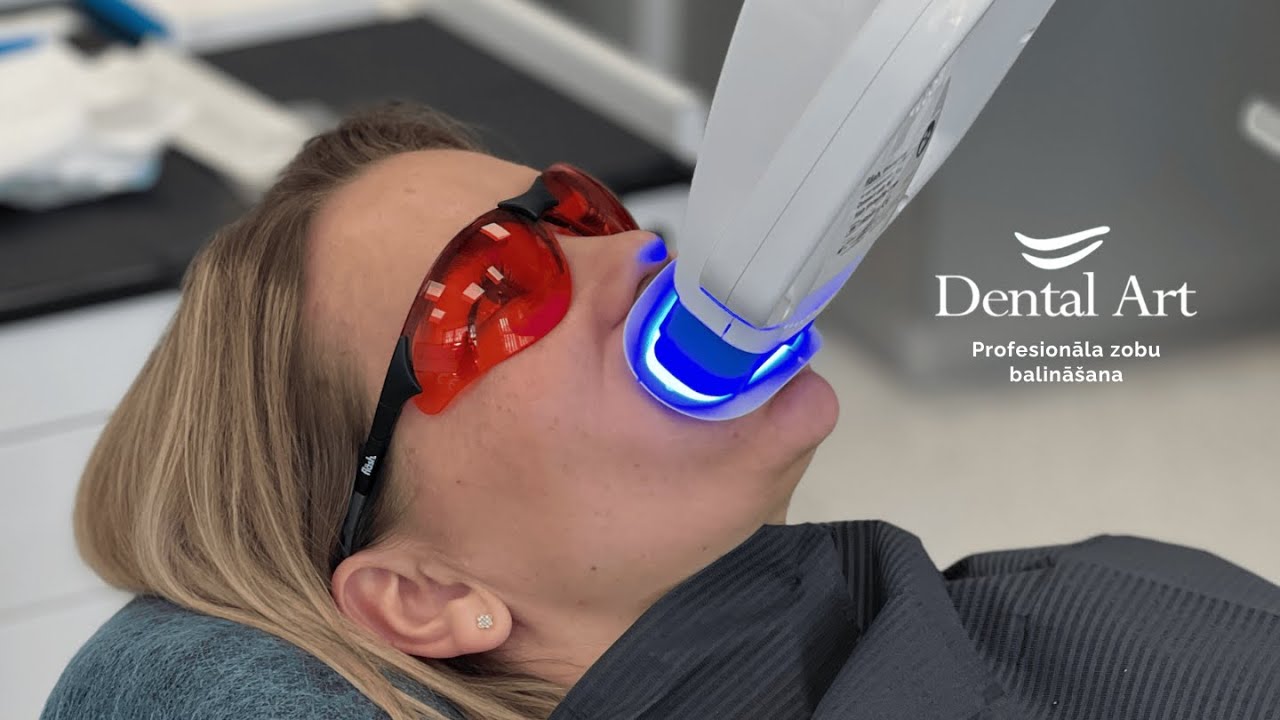 Profesionāla zobu balināšana klīnikā Dental Art