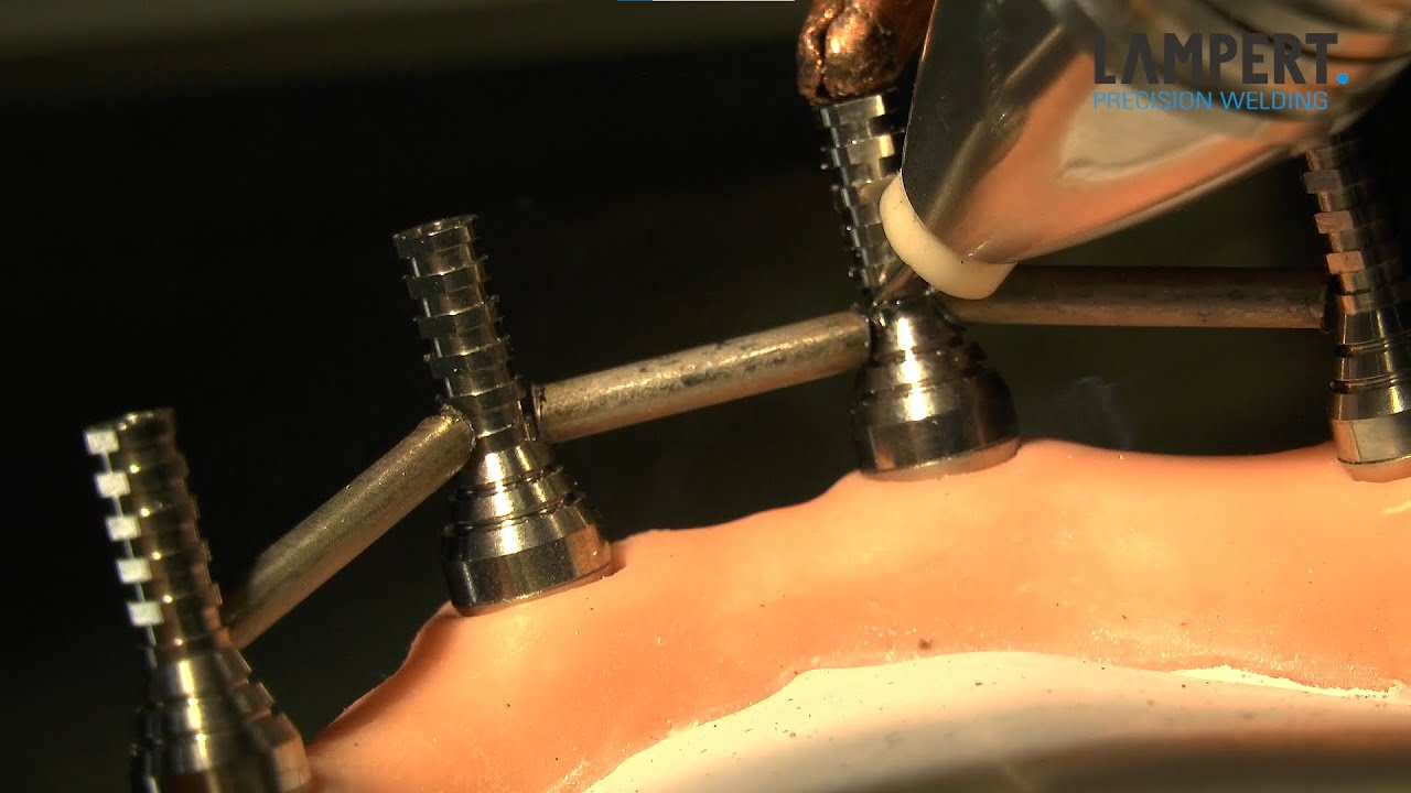 PUK dental welding - implant bar /  Implantatschiene