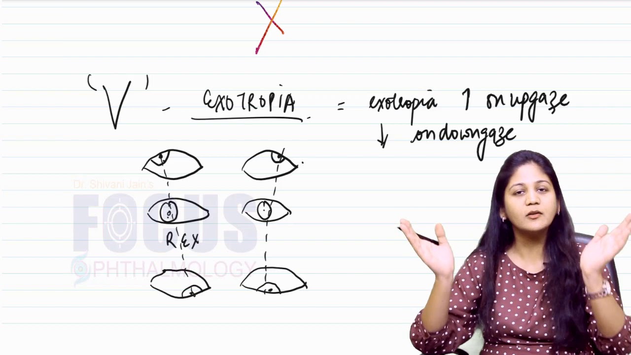 A short Video on Pattern squint