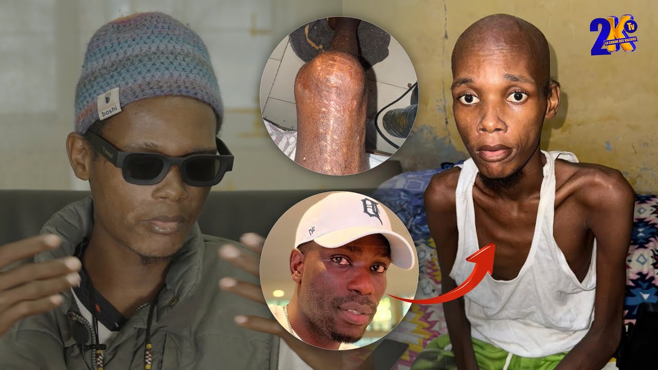 Samba Yoro à Cœur Ouvert : sa maladie - kalifone sall - l'argent cotisé...je suis millionnaire 