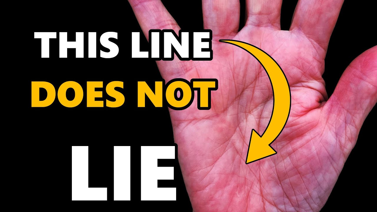 Ancient Health Lines Doctors Won't Tell You | Expert Hand Analysis