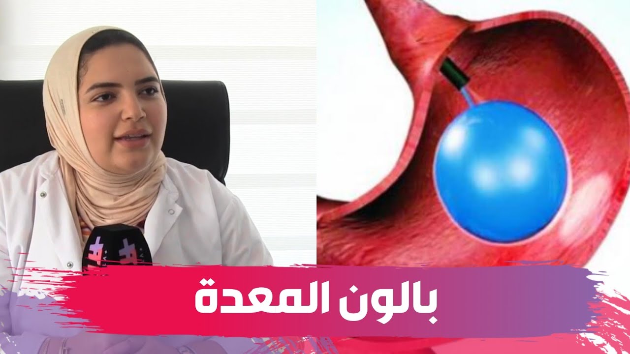 بدون جراحة وبدون تخدير.. بالون المعدة تقنية جديدة لإنقاص الوزن