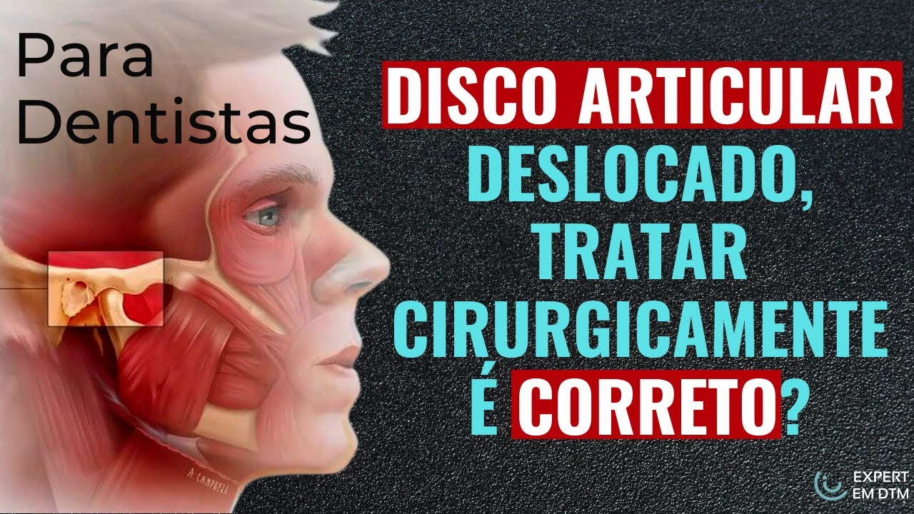 [DENTISTA] Disco articular deslocado, tratar cirurgicamente é correto?