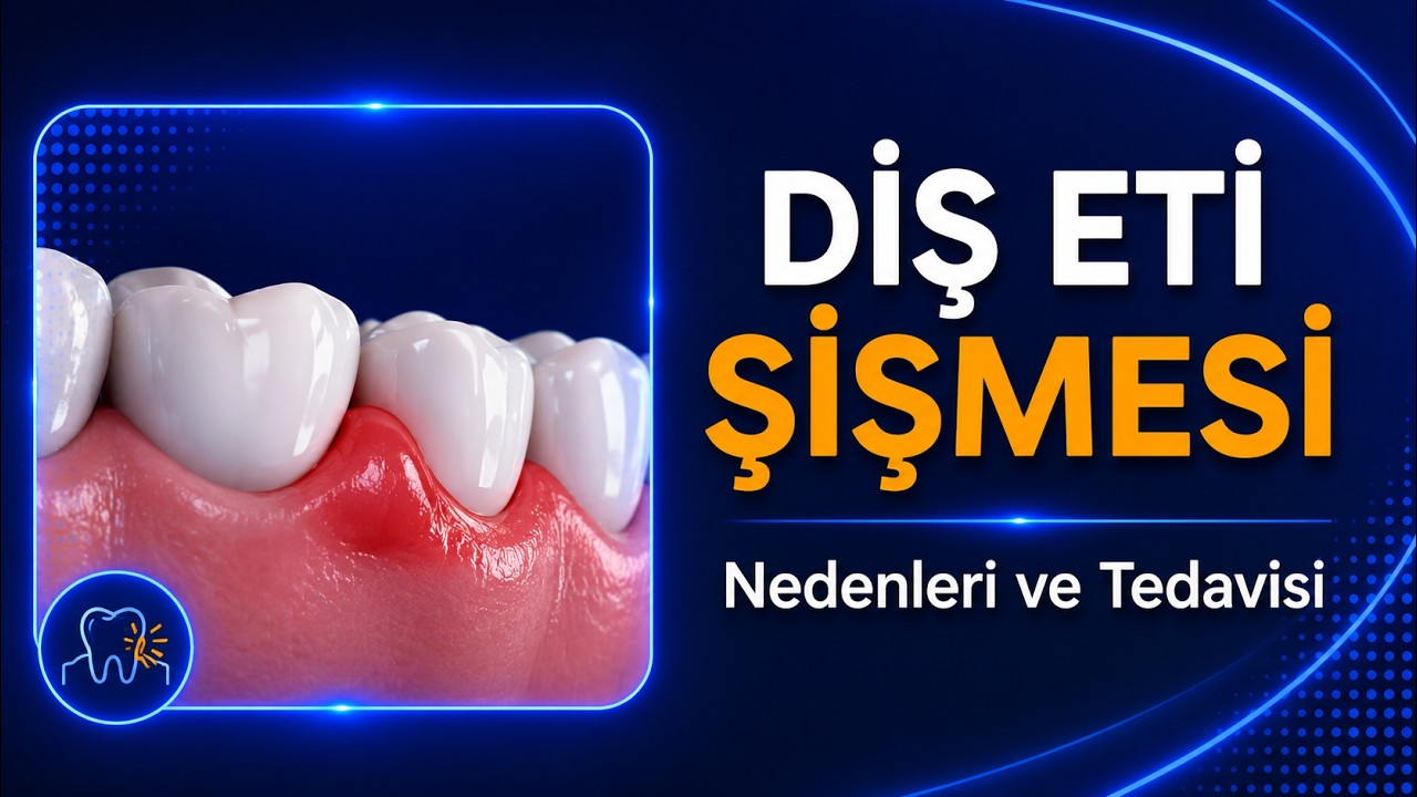 DİŞ ETİ ŞİŞMESİ Nedenleri ve Tedavisi