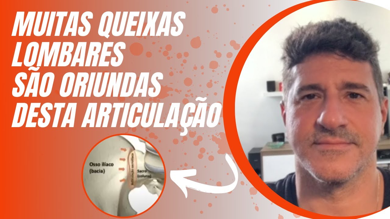 MUITAS QUEIXAS LOMBARES SÃO ORIUNDAS DESTA ARTICULAÇÃO