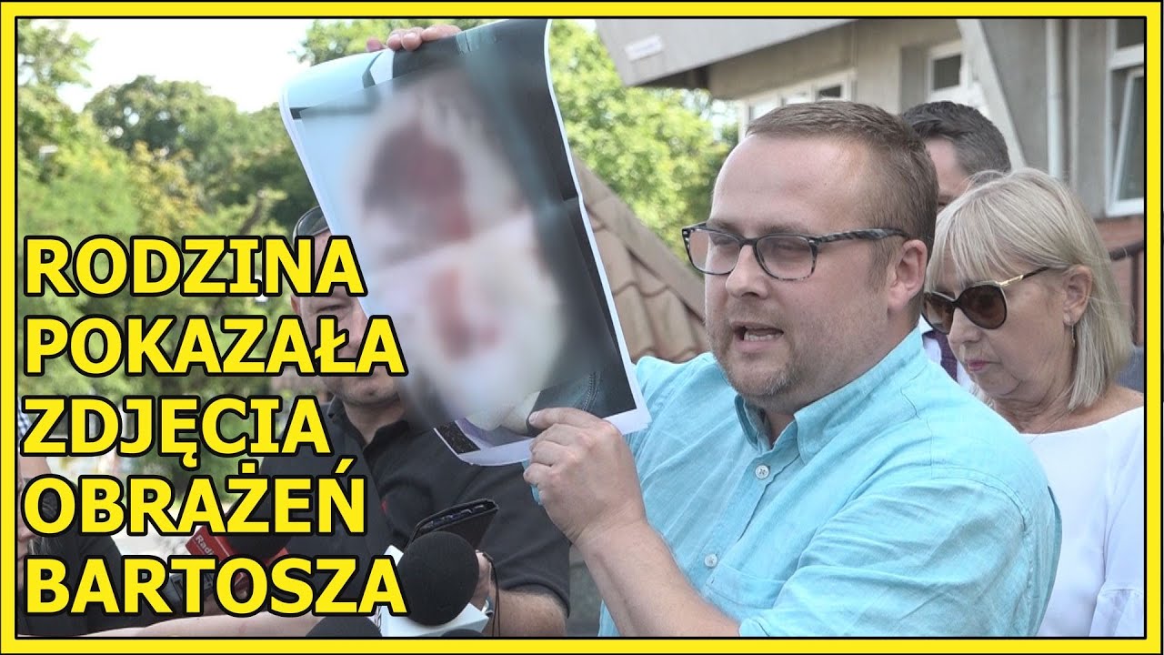 LUBIN. Rodzina pokazała zdjęcia obrażeń Bartosza