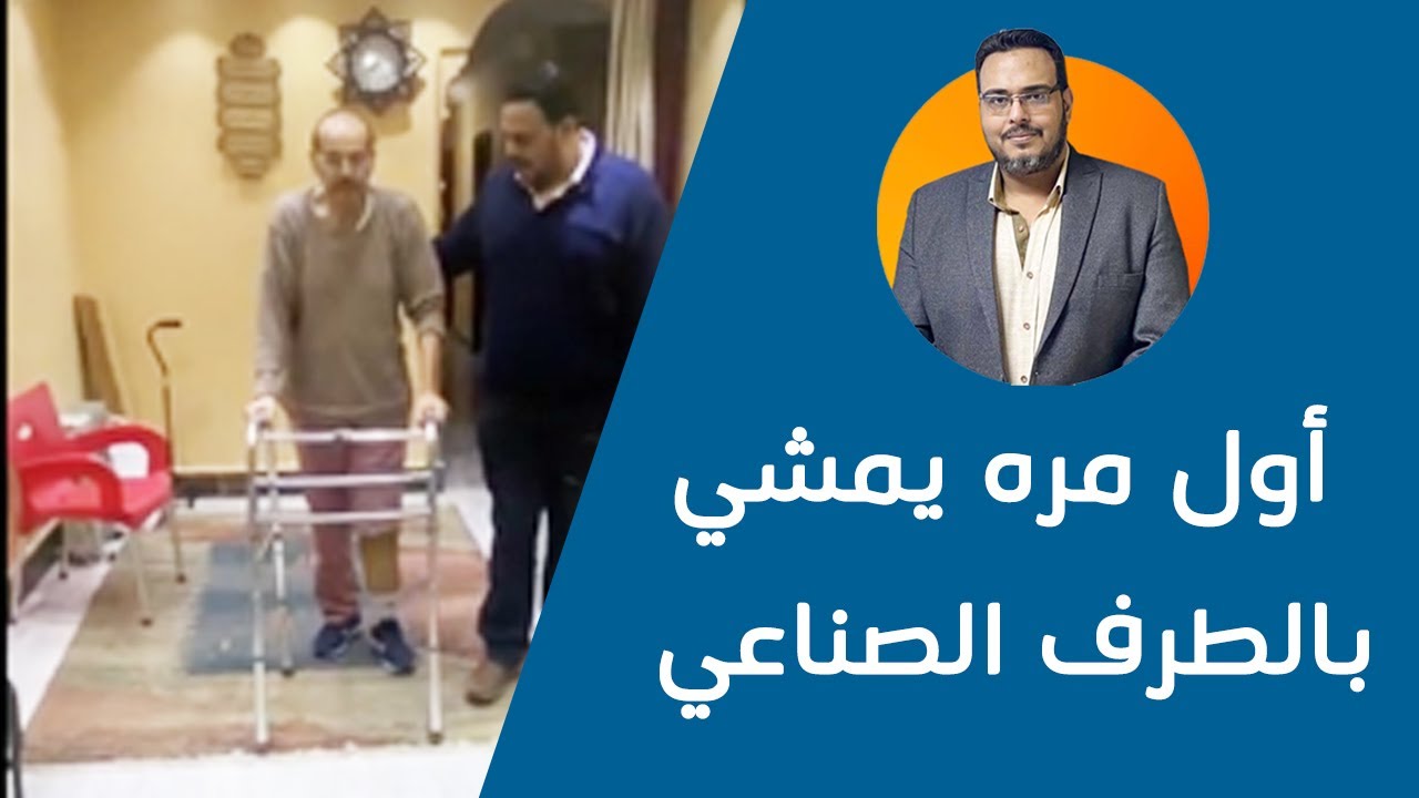 طرف صناعي لبتر فوق الركبة | الدكتور أحمد سمير