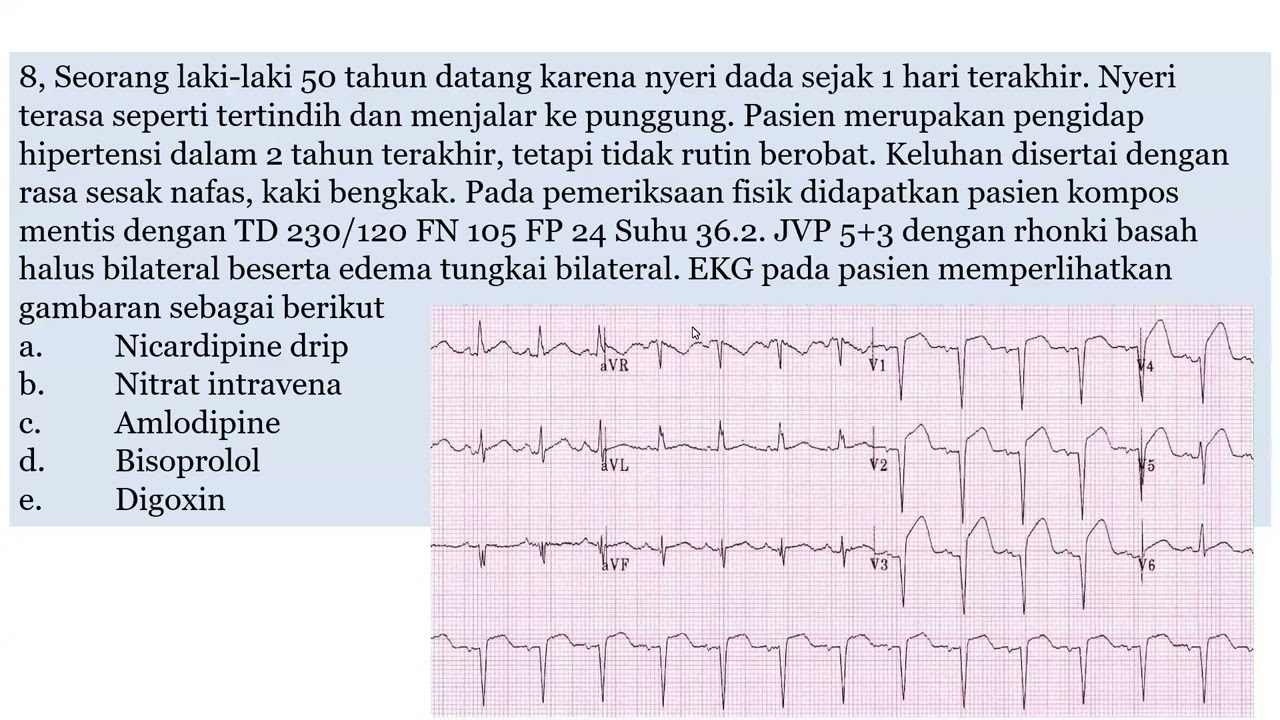 20240113 Mas Nuklir Bahas Soal Malam