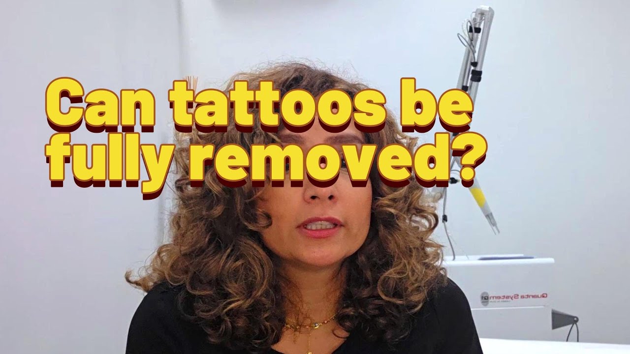 Can tattoos be fully removed?